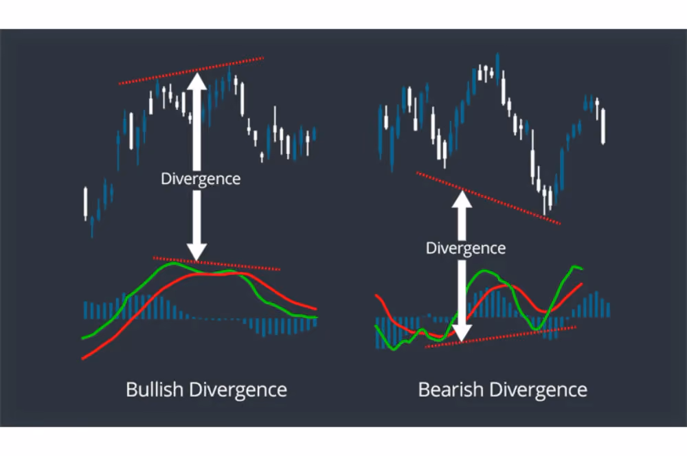 MACD divergence